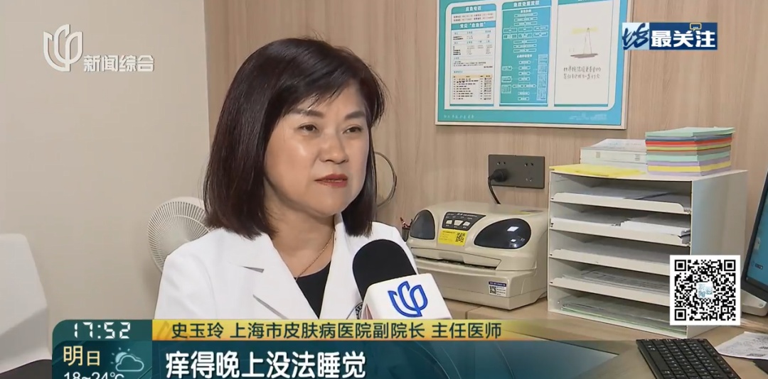 整晚睡不着! 沪一女子身上成片出现…近期高发,紧急提醒 整晚睡不着! 沪一女子身上成片出现…近期高发,紧急提醒