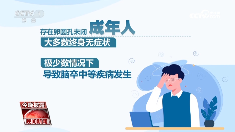 年轻不是“护身符”!警惕脑卒中,牢记“120口诀” 年轻不是“护身符”!警惕脑卒中,牢记“120口诀”