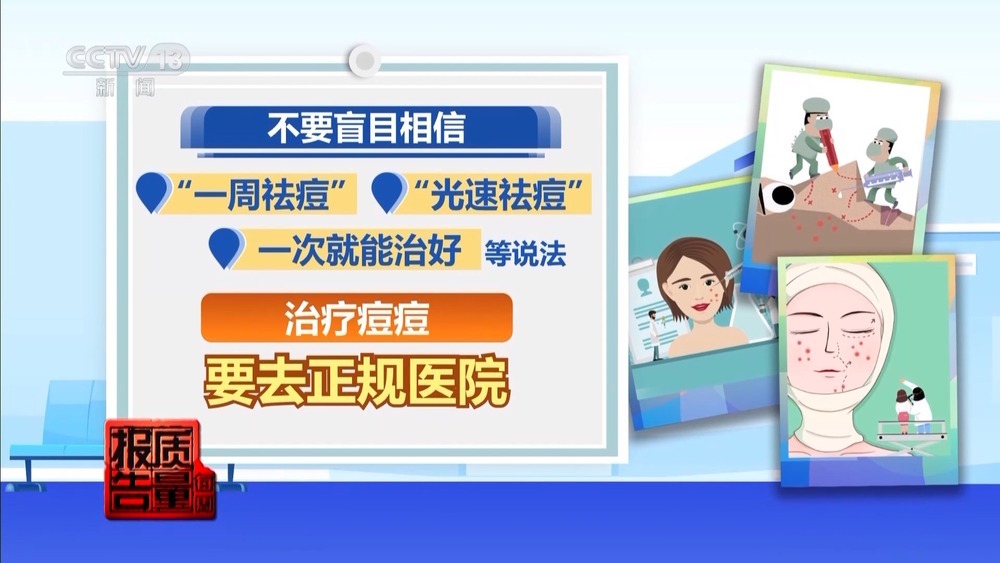 “针清”后痘痘不减反增 这些祛痘法操作不当可能会“烂脸” “针清”后痘痘不减反增 这些祛痘法操作不当可能会“烂脸”