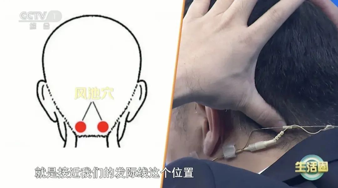 中国人死亡“第一元凶”不是癌症，而是它！