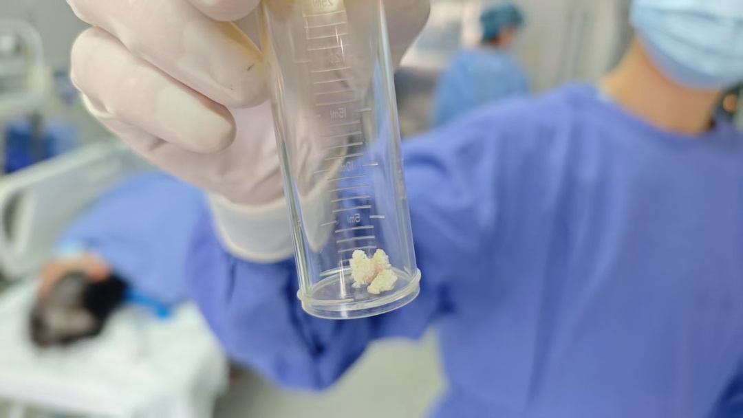 上海正大量上市！有人险丧命！医院12小时抢救3例，这事不是闹着玩的