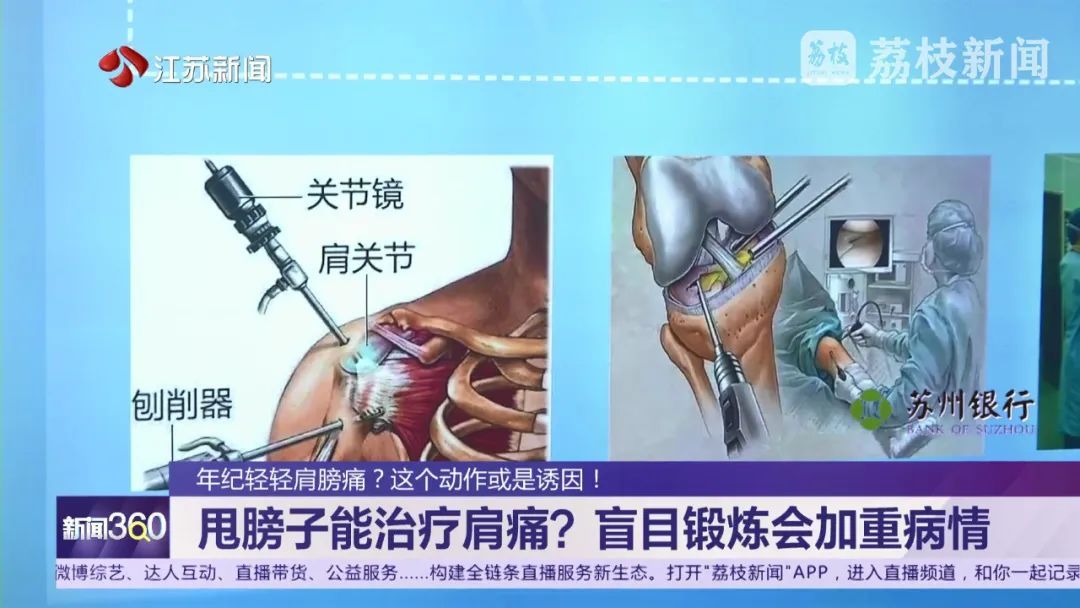 十几位年轻人同一种肩膀痛，医生发现他们有同一个坏习惯！可能你也有