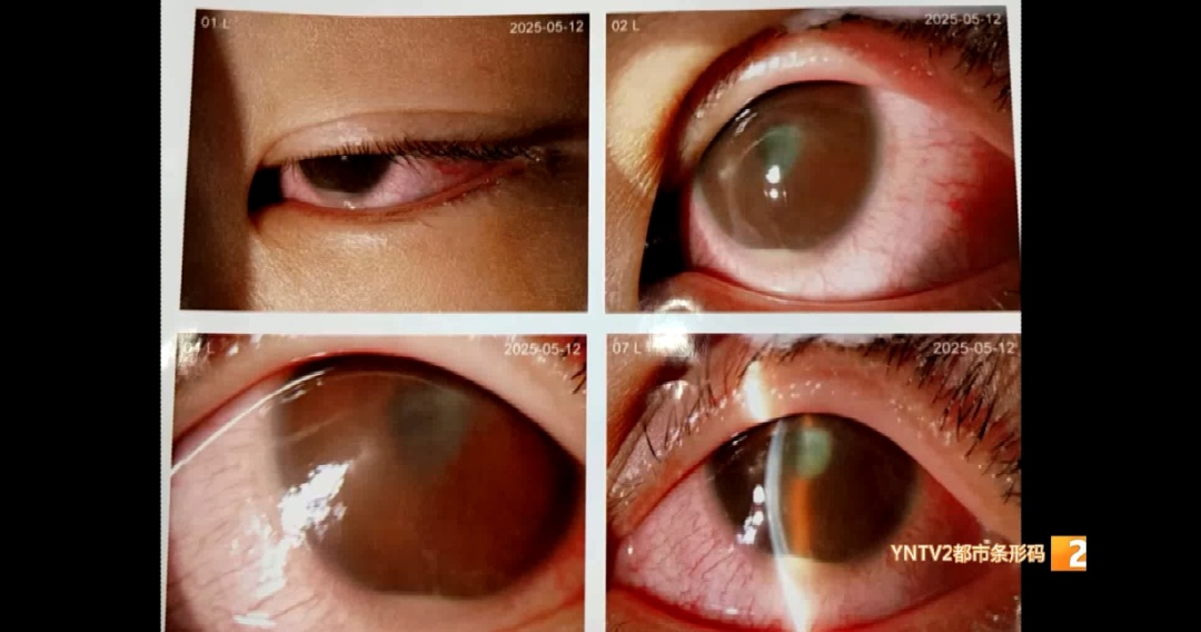 危险!云南2名孩子眼睛被戳伤,这种玩具有“暗器” 危险!云南2名孩子眼睛被戳伤,这种玩具有“暗器”