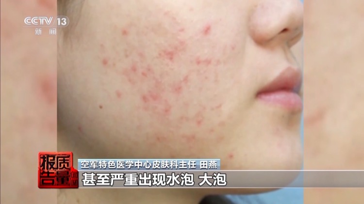 揭开防晒化妆品的“迷雾” “防护”还是“防晒”? 揭开防晒化妆品的“迷雾” “防护”还是“防晒”?