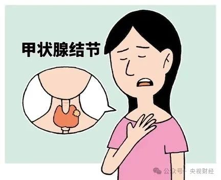 甲状腺结节切还是不切?有这些特征要警惕→ 甲状腺结节切还是不切?有这些特征要警惕→