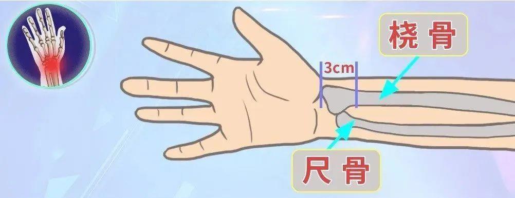 小伙以为摔了没事、7天后却死亡 摔倒后这些信号别忽视 小伙以为摔了没事、7天后却死亡 摔倒后这些信号别忽视