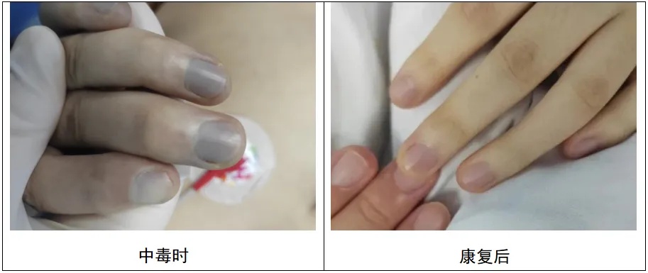 剧毒！一碗下肚，全身变紫！这道菜很多人家里都有…