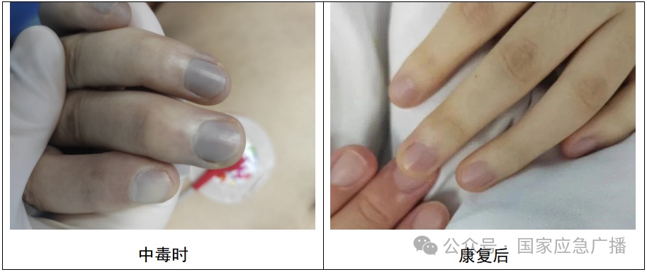 一碗下肚,男子变“紫”了!这道菜很多人爱吃…… 一碗下肚,男子变“紫”了!这道菜很多人爱吃……