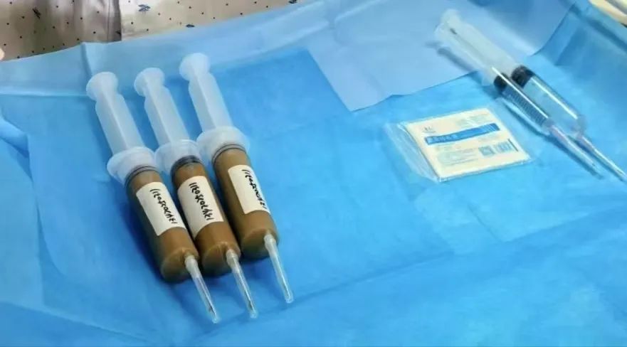 “便便”也能救人!男子被确诊“不死的癌症”,医生用粪菌移植治病 “便便”也能救人!男子被确诊“不死的癌症”,医生用粪菌移植治病