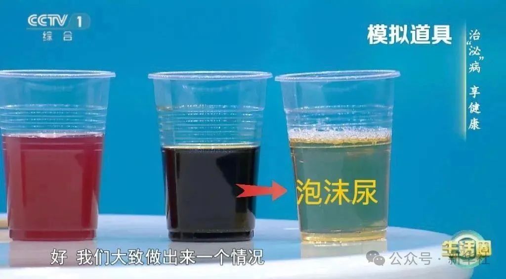 喝水后4个异常，可能是肾发出的“求救信号”！