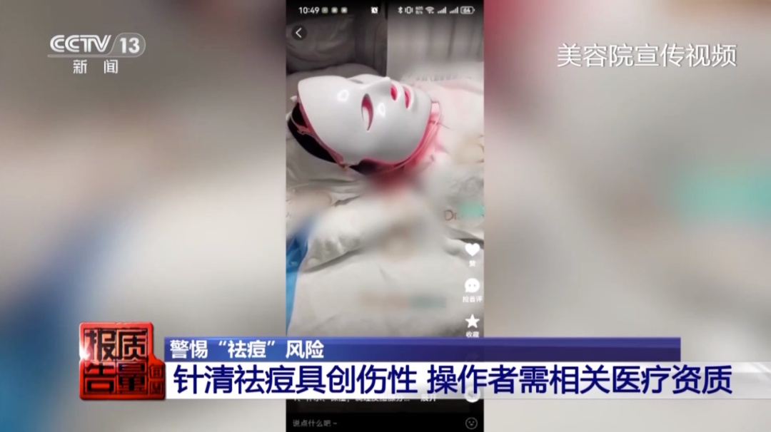 女子美容院祛痘,竟越祛越多!医生紧急提醒→ 女子美容院祛痘,竟越祛越多!医生紧急提醒→