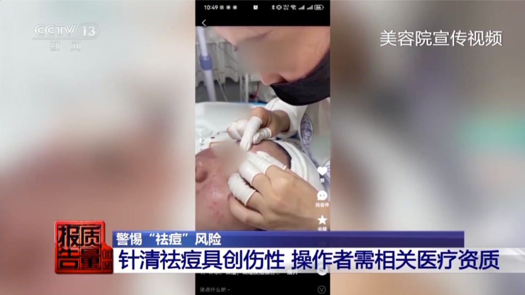 女子美容院祛痘,竟越祛越多!医生紧急提醒→ 女子美容院祛痘,竟越祛越多!医生紧急提醒→