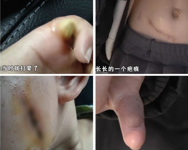 注意!户外这些地方容易漏电 注意!户外这些地方容易漏电