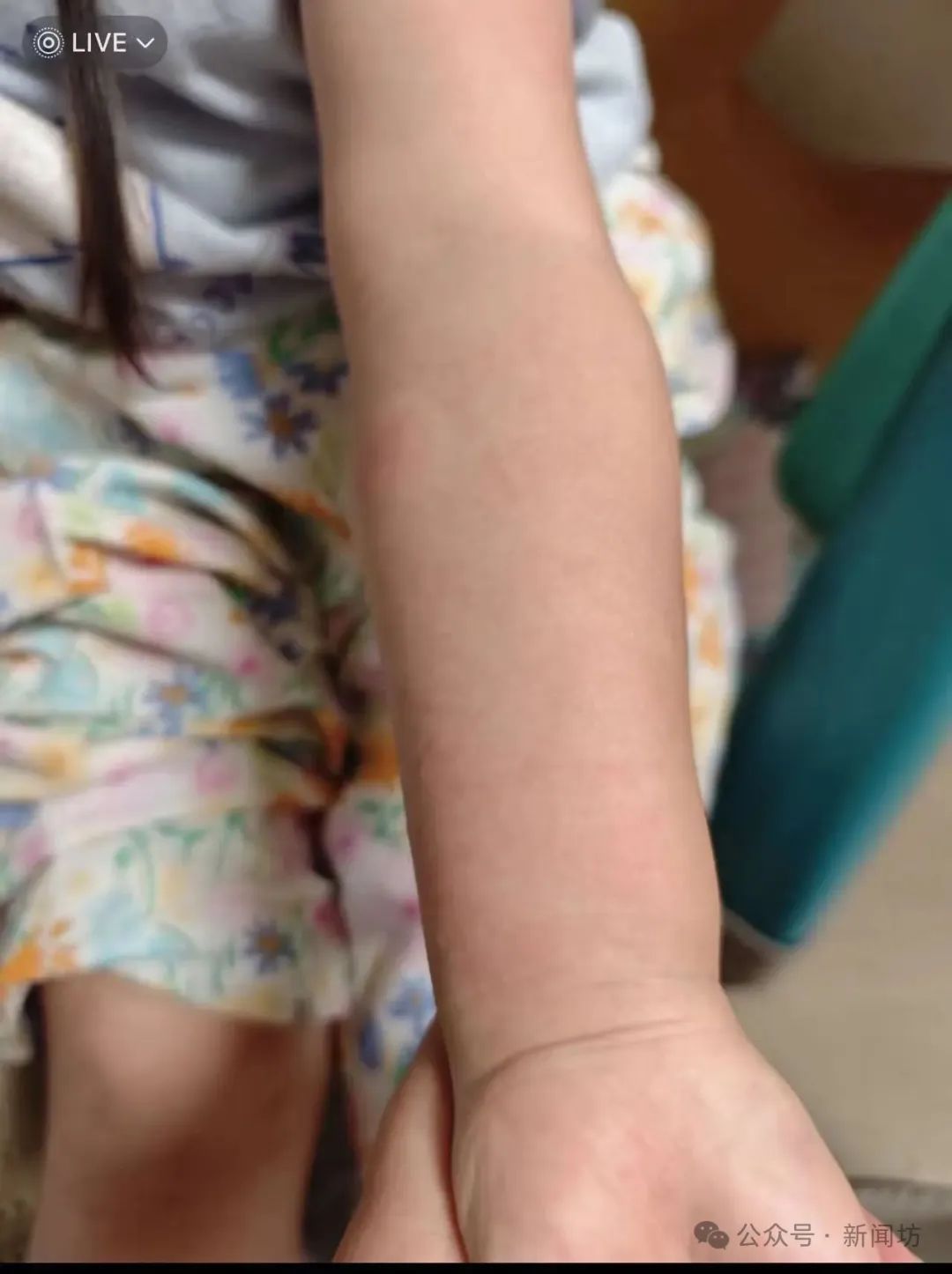 孩子摸了栏杆,回家后“手痒”去医院都清不干净……紧急提醒! 孩子摸了栏杆,回家后“手痒”去医院都清不干净……紧急提醒!