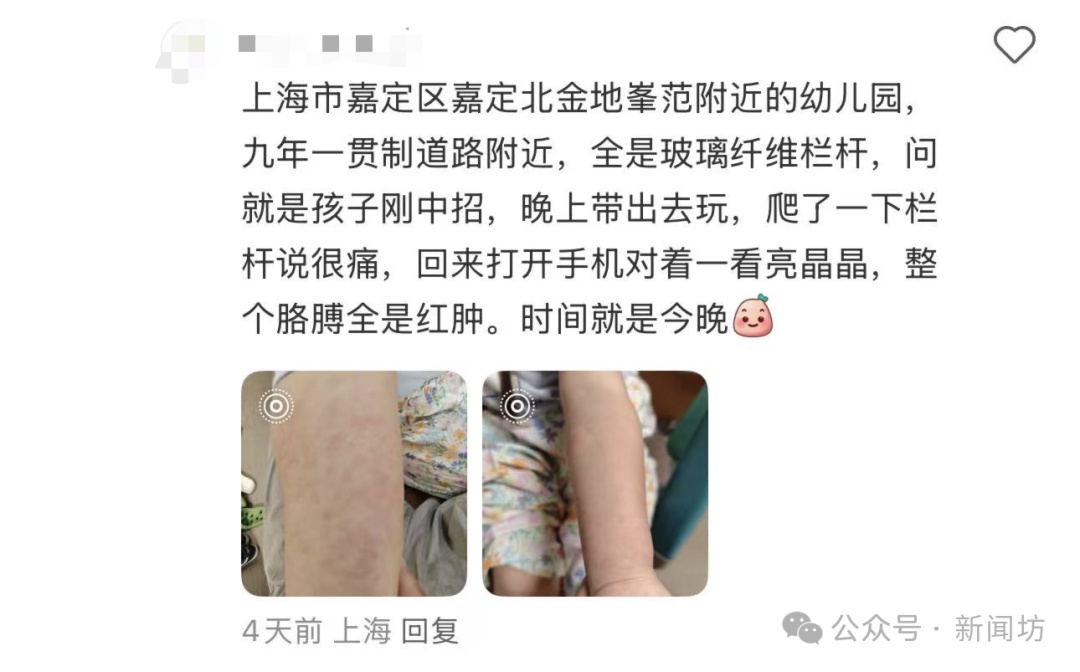 孩子摸了栏杆,回家后“手痒”去医院都清不干净……紧急提醒! 孩子摸了栏杆,回家后“手痒”去医院都清不干净……紧急提醒!