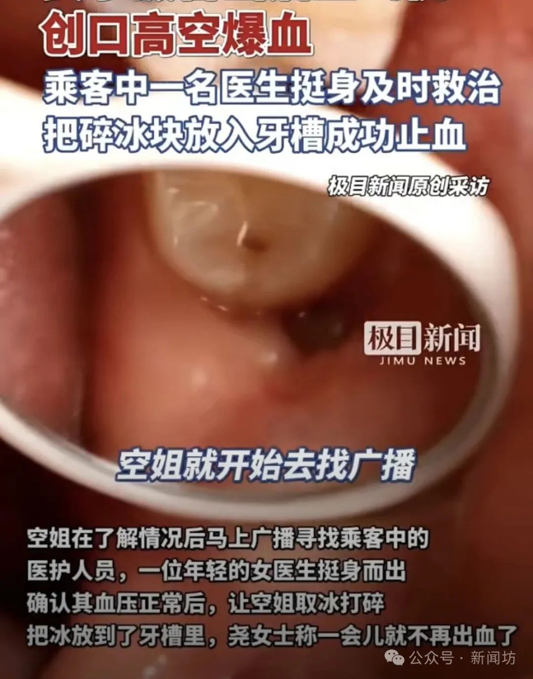 女子坐飞机嘴里突然开始冒鲜血……医生紧急提醒! 女子坐飞机嘴里突然开始冒鲜血……医生紧急提醒!