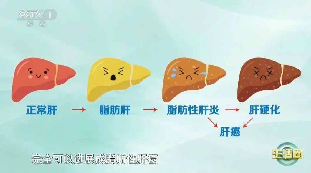 只是肚子大？小心内脏脂肪超标！