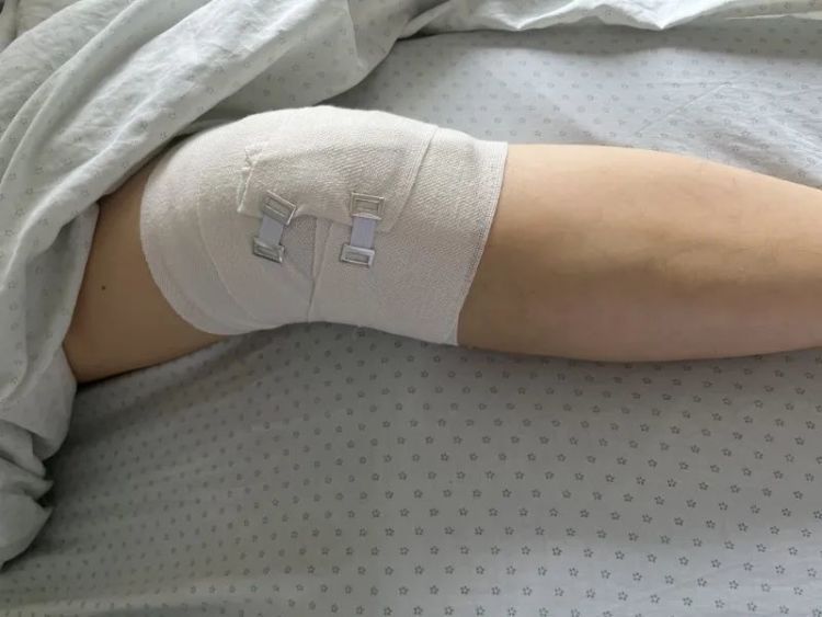 杭州一女子因登高采摘枇杷,竟导致骨折,专家提醒 杭州一女子因登高采摘枇杷,竟导致骨折,专家提醒