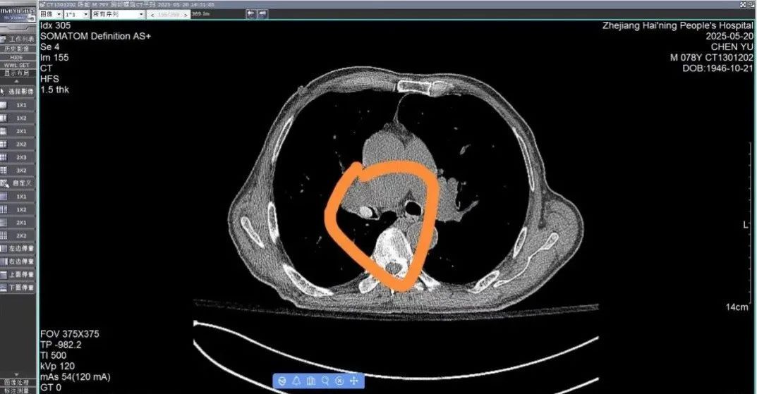 正大量上市！浙江有人吃它进了ICU，医生提醒：老人小孩尤其要当心……