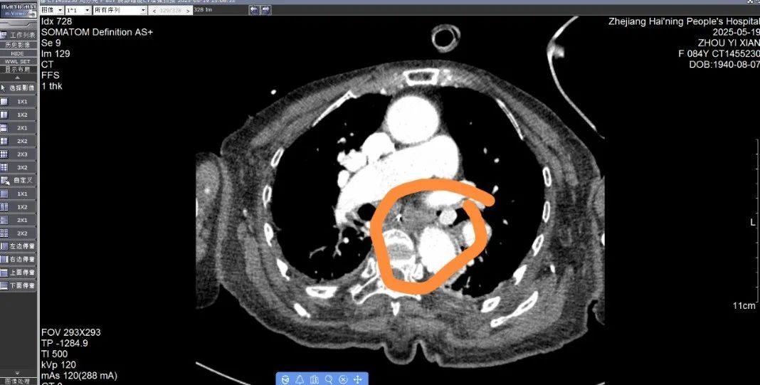 正大量上市！浙江有人吃它进了ICU，医生提醒：老人小孩尤其要当心……