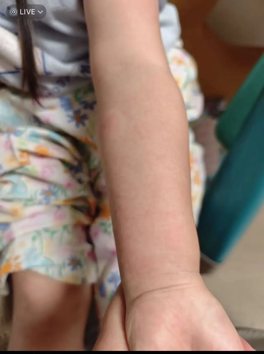 很痒!去医院也清理不干净!很多人家里就有,不要摸…… 很痒!去医院也清理不干净!很多人家里就有,不要摸……