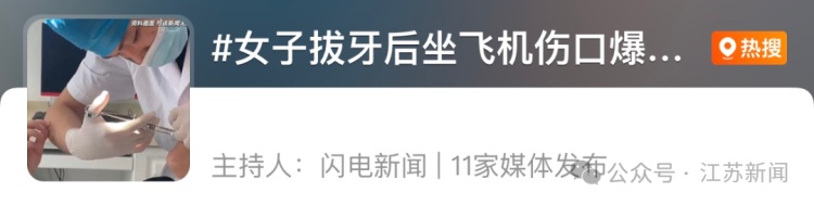 女子拔牙后坐飞机伤口爆开冒鲜血……医生紧急提醒 女子拔牙后坐飞机伤口爆开冒鲜血……医生紧急提醒