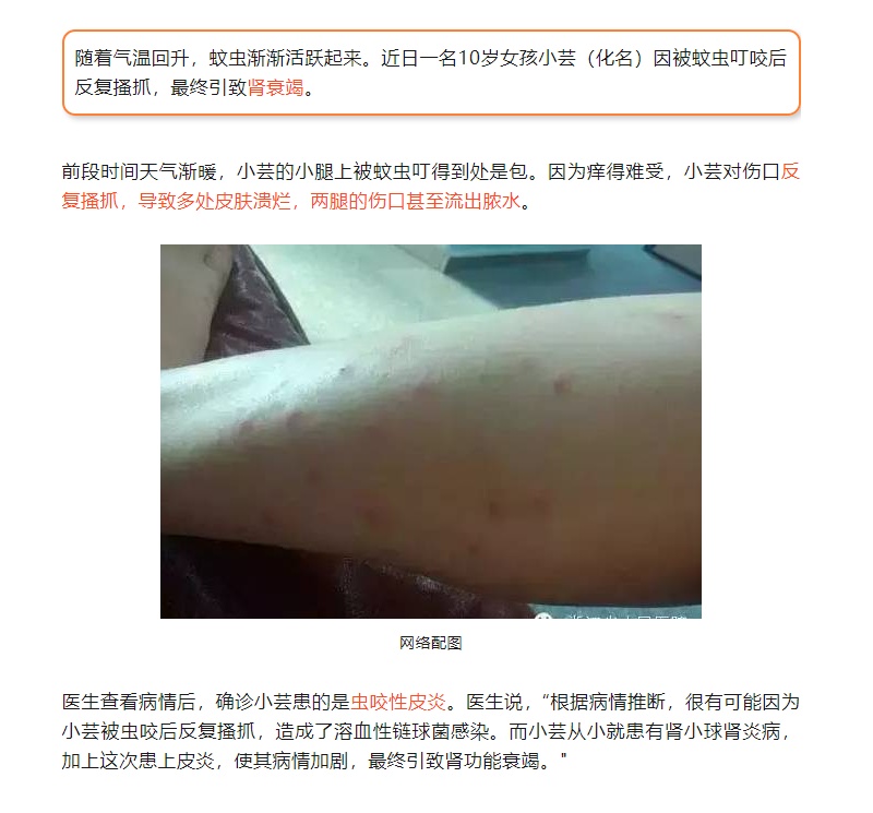 9岁男童感觉头疼胸闷，竟确诊肾炎！医生提醒：是因为这个习惯