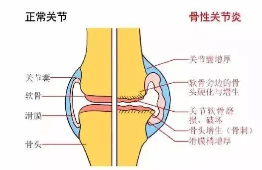 膝盖使用说明书:从今天开始“省着用” 膝盖使用说明书:从今天开始“省着用”