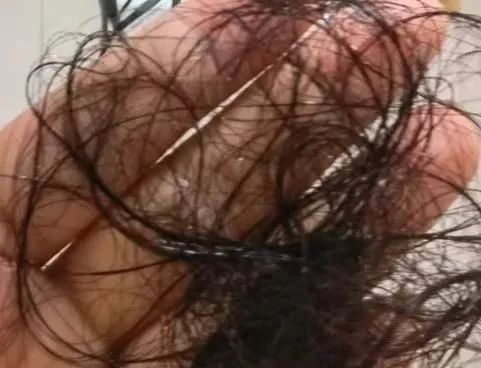 出现这些脱发情况要警惕!正确洗头方式来了,很多人第一步就错了—— 出现这些脱发情况要警惕!正确洗头方式来了,很多人第一步就错了——