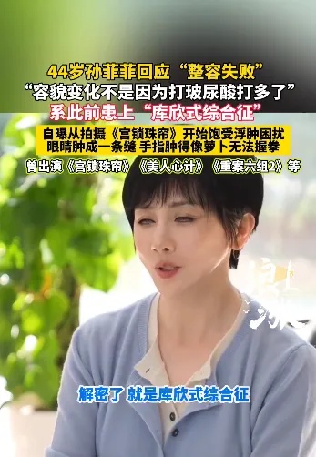 罕露面变化大!知名女演员回应“整容失败”:并非玻尿酸打多了,竟是染上这种病 罕露面变化大!知名女演员回应“整容失败”:并非玻尿酸打多了,竟是染上这种病