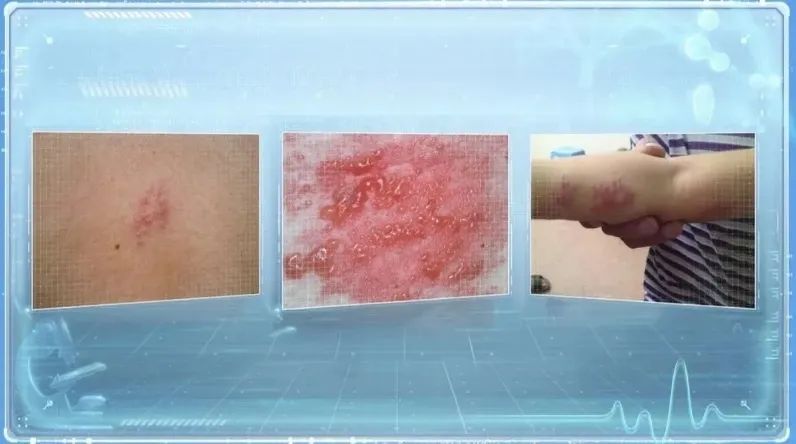 惊呆!男子拆快递时切断大动脉,鲜血直喷!还有人拆完腹痛腹泻、眼红发痒... 惊呆!男子拆快递时切断大动脉,鲜血直喷!还有人拆完腹痛腹泻、眼红发痒...