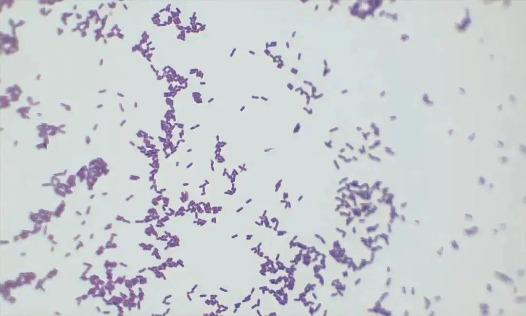 警惕“冰箱杀手”!有人已因此死亡 警惕“冰箱杀手”!有人已因此死亡