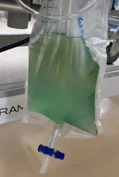 陷入深昏迷! 25岁小伙全身青紫,尿液呈"诡异蓝色"! 医生: 剧毒,0.5克可致命 陷入深昏迷! 25岁小伙全身青紫,尿液呈"诡异蓝色"! 医生: 剧毒,0.5克可致命