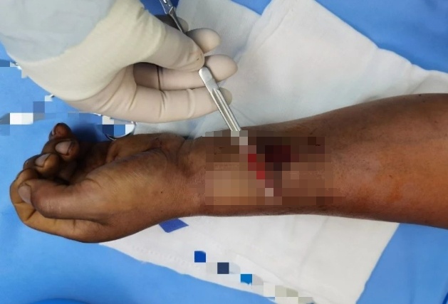 男子拆快递时切断大动脉鲜血直喷,拆快递注意这几点→ 男子拆快递时切断大动脉鲜血直喷,拆快递注意这几点→