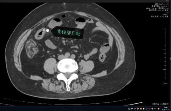 好吃却可能惹出大麻烦,警惕粽子里的“隐形刺客” 好吃却可能惹出大麻烦,警惕粽子里的“隐形刺客”