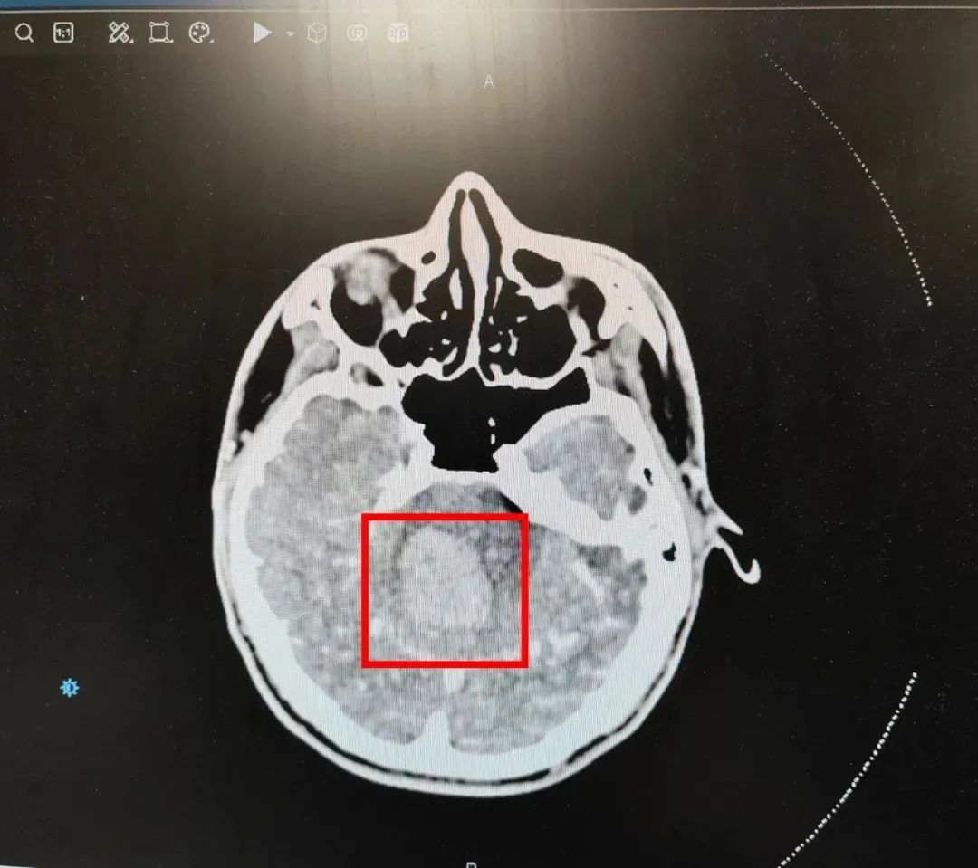 “00后”小伙，撸铁后陷入昏迷！