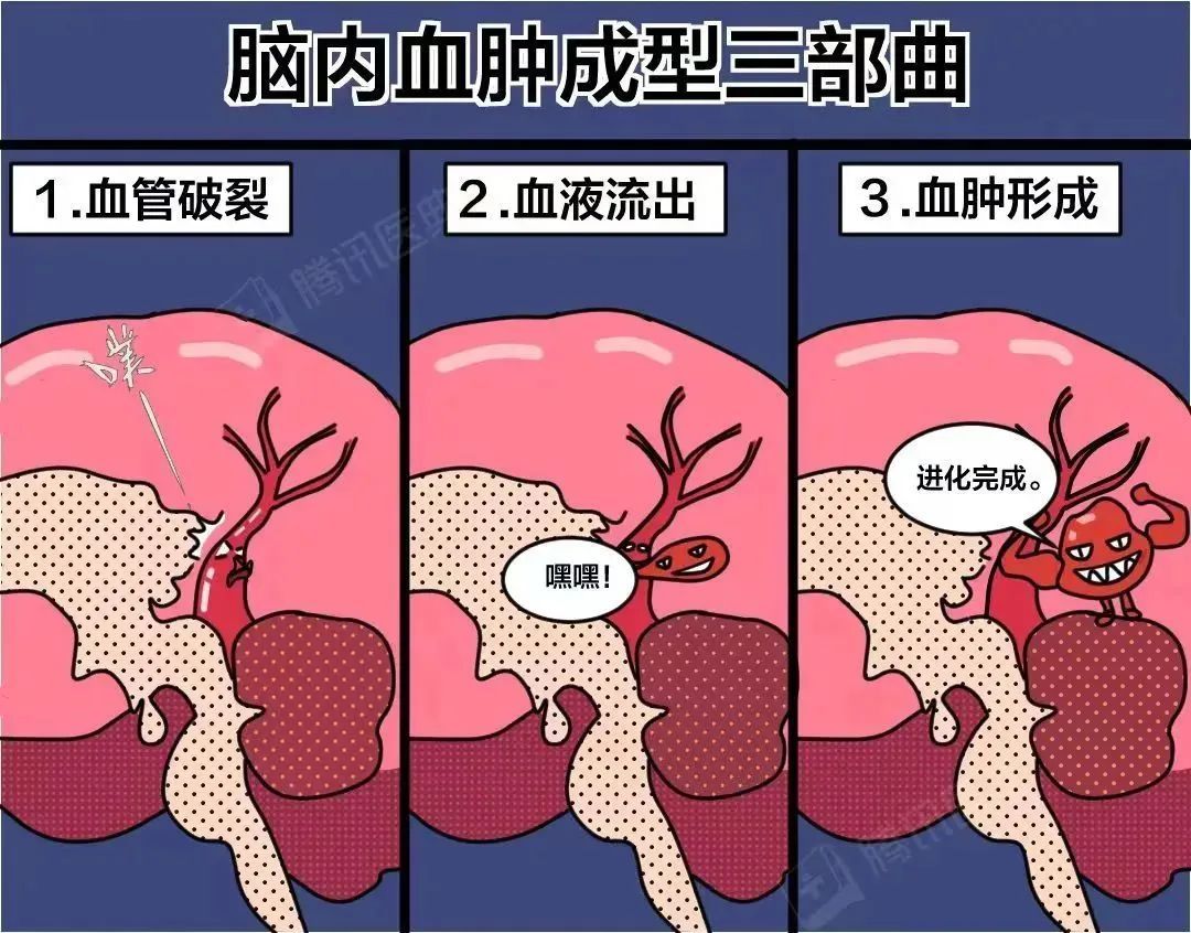 “00后”小伙，撸铁后陷入昏迷！