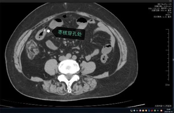 紧急提醒！已接诊多例！警惕粽子里的“隐形刺客”