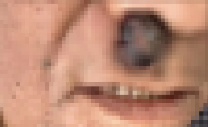 男子癌症晚期全身恶臭!上海专家拒绝手术,最后却因这句话被说动了 男子癌症晚期全身恶臭!上海专家拒绝手术,最后却因这句话被说动了