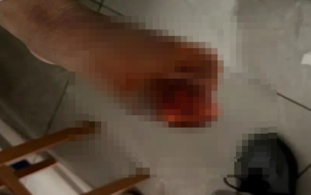 男子癌症晚期全身恶臭!上海专家拒绝手术,最后却因这句话被说动了 男子癌症晚期全身恶臭!上海专家拒绝手术,最后却因这句话被说动了