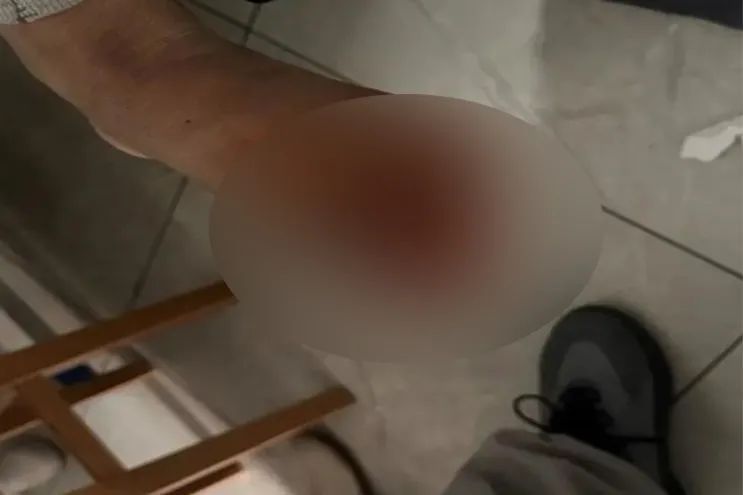 男子癌症晚期、全身恶臭……上海专家拒绝手术，但最后被他说动了