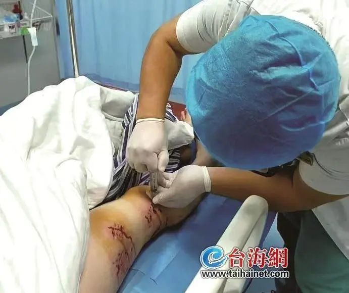 手臂肌腱被咬断!近期激增!一旦发病,致死率几乎100% 手臂肌腱被咬断!近期激增!一旦发病,致死率几乎100%