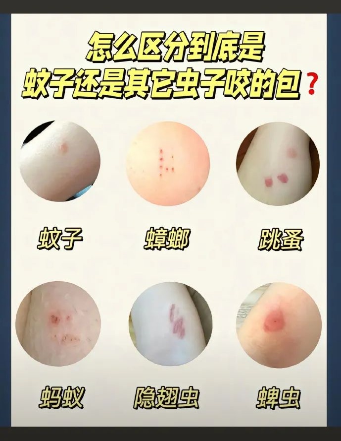 “蟑螂咬人”冲上热搜！广东网友急了