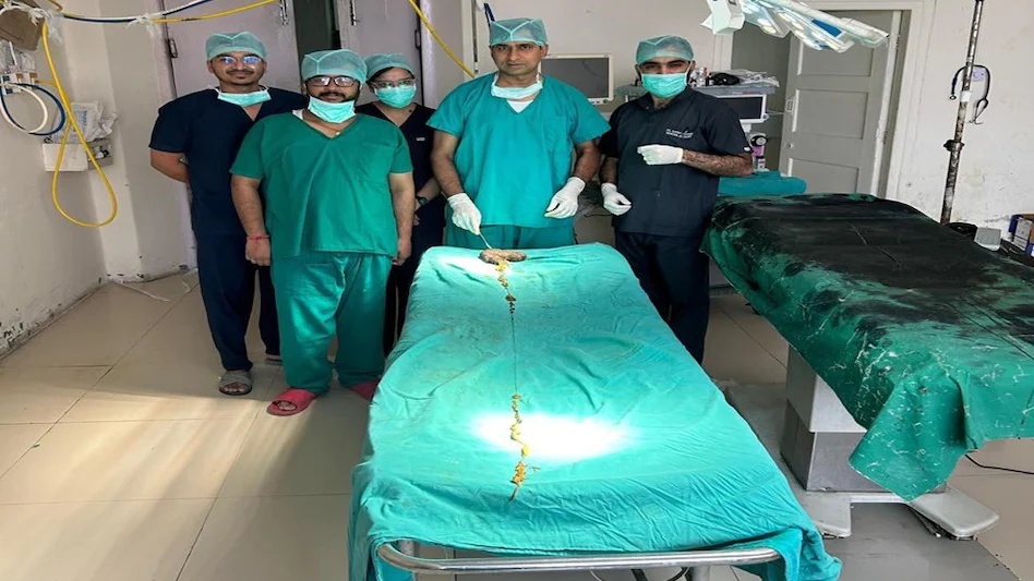 印度14岁少女腹中取出210厘米毛发结石,创世界纪录 印度14岁少女腹中取出210厘米毛发结石,创世界纪录