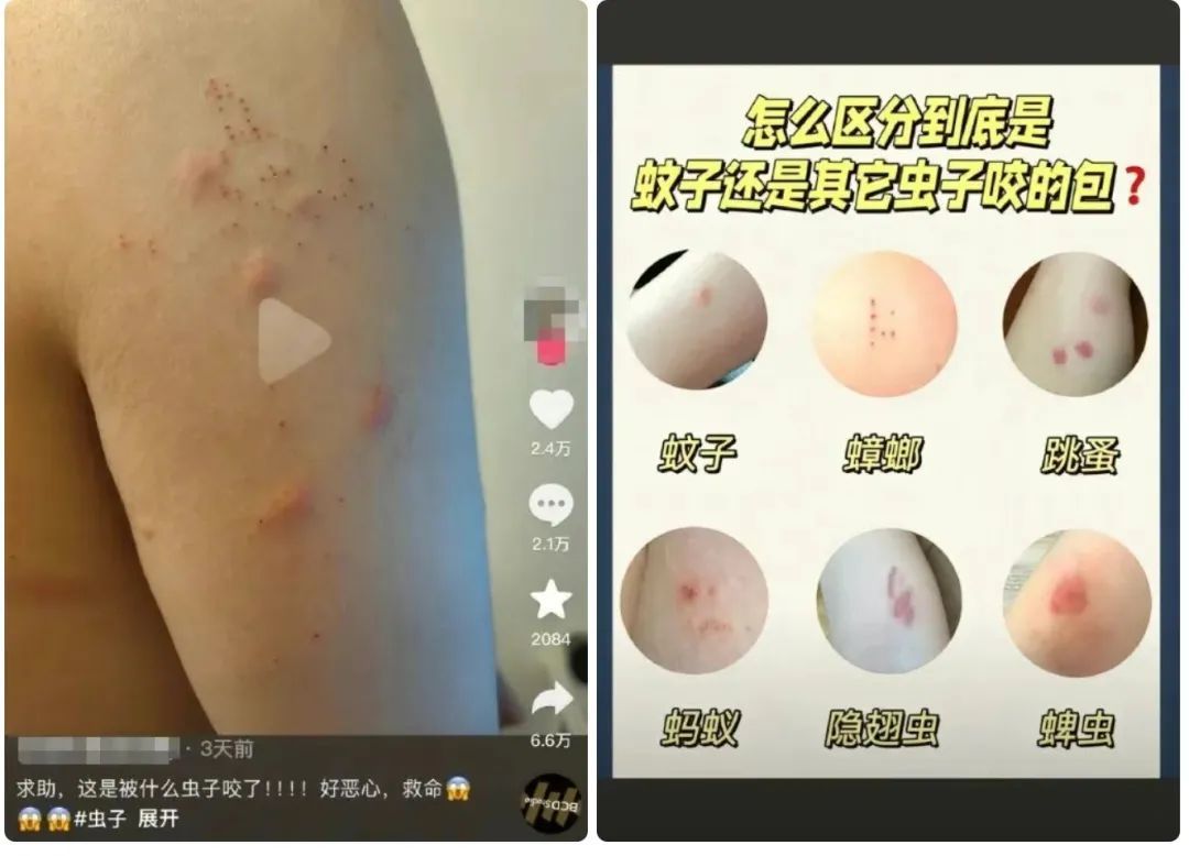 广东网友:“蟑螂会咬人”,疾控专家提醒→ 广东网友:“蟑螂会咬人”,疾控专家提醒→