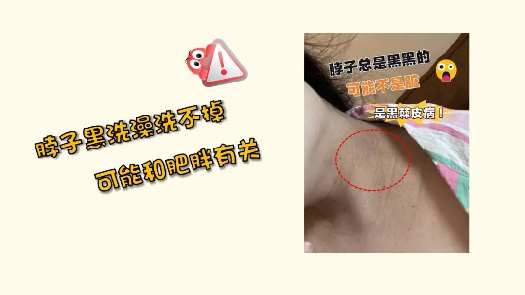 不用饿肚子!专家支招让娃轻松“掉秤”不反弹! 不用饿肚子!专家支招让娃轻松“掉秤”不反弹!