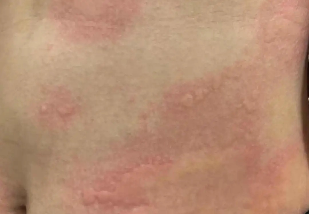 吓人！浙江小伙吃了这东西，直接休克！好多人都爱吃