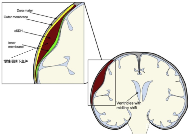 你以为没事的“小磕碰”有多危险?警惕这种隐匿的致命伤 你以为没事的“小磕碰”有多危险?警惕这种隐匿的致命伤