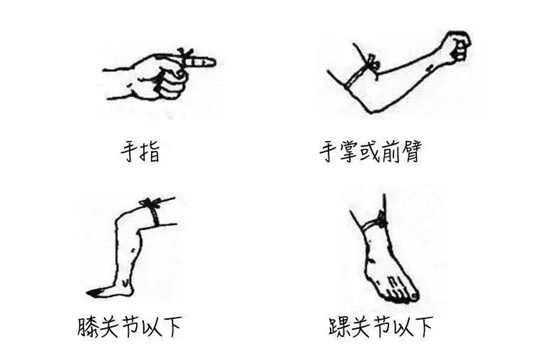 27岁女子被咬后身亡!近期高发,紧急提醒 27岁女子被咬后身亡!近期高发,紧急提醒