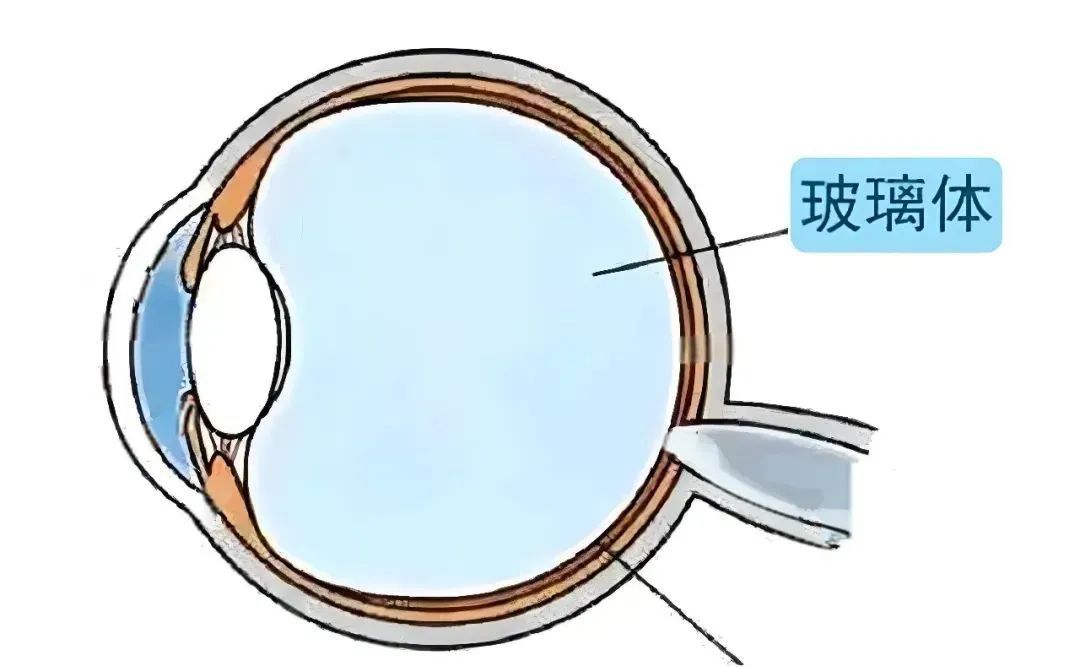 眼前“小飞虫”到底是什么?一文教你分清“生理性”还是“病理性” 眼前“小飞虫”到底是什么?一文教你分清“生理性”还是“病理性”